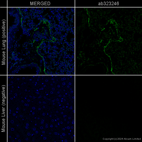 Anti-CD34 antibody [EPR27431-71] – Human IgG (Chimeric) (ab323246) | Abcam