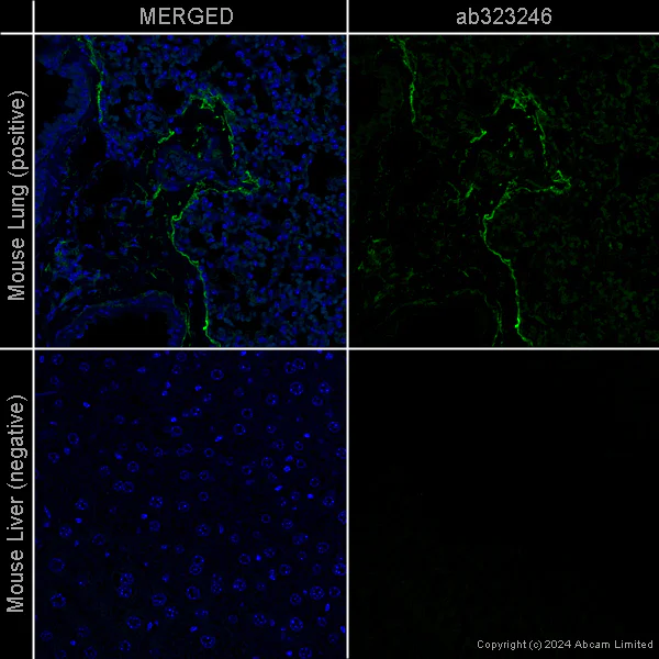 Immunohistochemistry (Formalin/PFA-fixed paraffin-embedded sections) - Anti-CD34 antibody [EPR27431-71] – Human IgG (Chimeric) – BSA and Azide Free (AB323255)