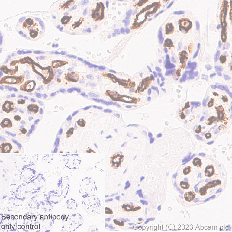 Immunohistochemistry (Formalin/PFA-fixed paraffin-embedded sections) - Anti-CD34 antibody [EPR27432-54] (AB315802)