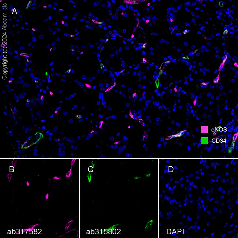 Multiplex immunohistochemistry - Anti-CD34 antibody [EPR27432-54] - BSA and Azide free (AB315803)