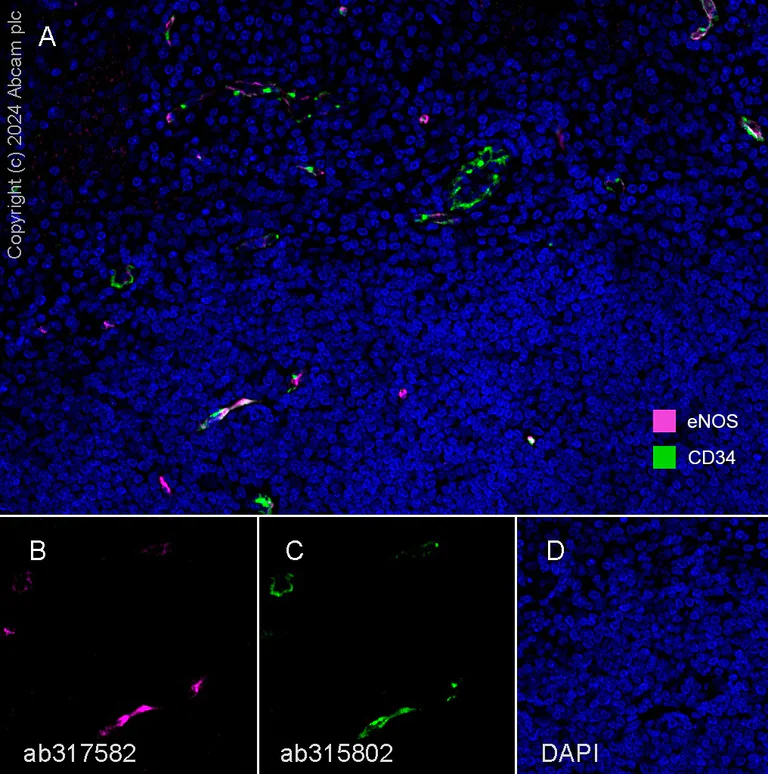 Multiplex immunohistochemistry - Anti-CD34 antibody [EPR27432-54] - BSA and Azide free (AB315803)