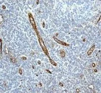 Immunohistochemistry (Formalin/PFA-fixed paraffin-embedded sections) - Anti-CD34 antibody [EPR2999] (AB110643)
