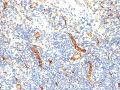 Immunohistochemistry (Formalin/PFA-fixed paraffin-embedded sections) - Anti-CD34 antibody [HPCA1/1171] - BSA and Azide free (AB213058), expandable thumbnail