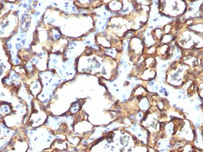 Immunohistochemistry (Formalin/PFA-fixed paraffin-embedded sections) - Anti-CD34 antibody [HPCA1/1171] - BSA and Azide free (AB213058), expandable thumbnail