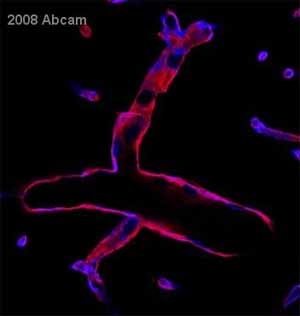 Immunohistochemistry (Formalin/PFA-fixed paraffin-embedded sections) - Anti-CD34 antibody [MEC 14.7] (AB8158), expandable thumbnail