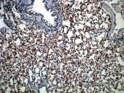 Immunohistochemistry (Formalin/PFA-fixed paraffin-embedded sections) - Anti-CD34 antibody [MEC 14.7] (AB8158), expandable thumbnail