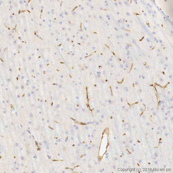 Immunohistochemistry (Formalin/PFA-fixed paraffin-embedded sections) - Anti-CD34 antibody [MEC 14.7] (ab8158), expandable thumbnail