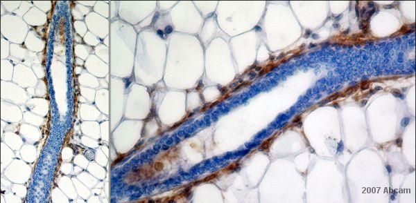 Immunohistochemistry (Formalin/PFA-fixed paraffin-embedded sections) - Anti-CD34 antibody [MEC 14.7] (AB8158), expandable thumbnail