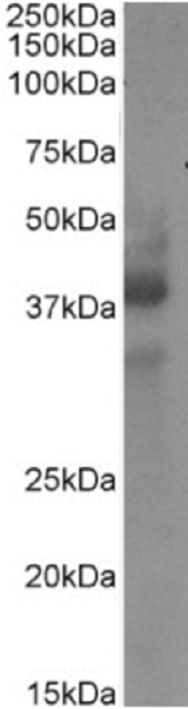 Western blot - Anti-CD34 antibody [My10] (AB245689), expandable thumbnail