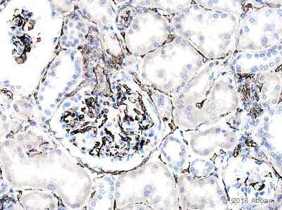 Immunohistochemistry (Formalin/PFA-fixed paraffin-embedded sections) - Anti-CD34 antibody [QBEND/10] (AB8536)