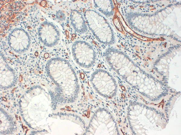 Immunohistochemistry (Formalin/PFA-fixed paraffin-embedded sections) - Anti-CD34 antibody [QBEND/10] (AB8536)