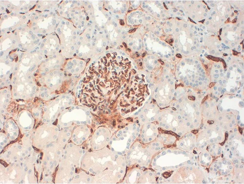 Immunohistochemistry (Formalin/PFA-fixed paraffin-embedded sections) - Anti-CD34 antibody [QBEND/10] (AB8536)