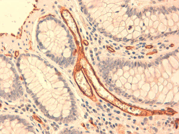 Immunohistochemistry (Formalin/PFA-fixed paraffin-embedded sections) - Anti-CD34 antibody [QBEND/10] (AB8536)
