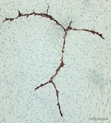 Immunohistochemistry (Formalin/PFA-fixed paraffin-embedded sections) - Anti-CD34 antibody [QBEND/10] (AB8536)