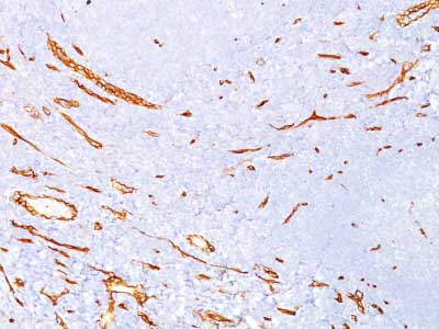Immunohistochemistry (Formalin/PFA-fixed paraffin-embedded sections) - Anti-CD34 antibody [QBEND/10] - BSA and Azide free (AB213054)