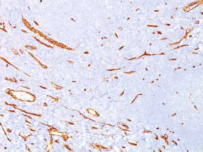 Immunohistochemistry (Formalin/PFA-fixed paraffin-embedded sections) - Anti-CD34 antibody [QBEND/10] - BSA and Azide free (AB213054)