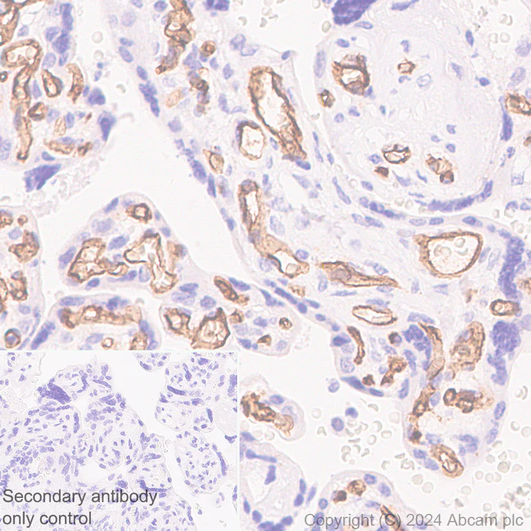 Immunohistochemistry (Formalin/PFA-fixed paraffin-embedded sections) - Anti-CD34 antibody [RM2052] - BSA and Azide free (AB317589)