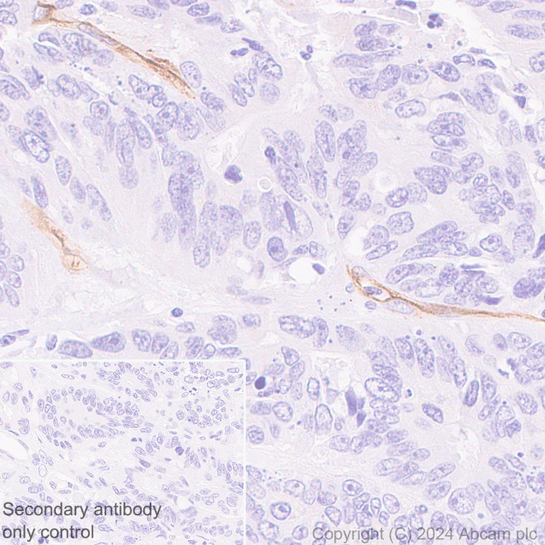 Immunohistochemistry (Formalin/PFA-fixed paraffin-embedded sections) - Anti-CD34 antibody [RM2052] - BSA and Azide free (AB317589)