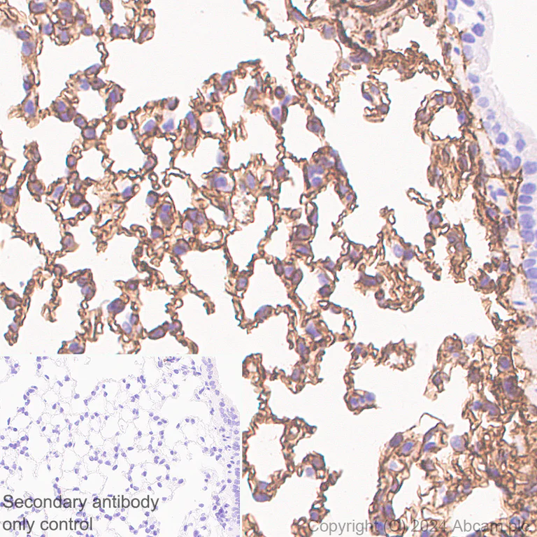 Immunohistochemistry (Formalin/PFA-fixed paraffin-embedded sections) - Anti-CD34 antibody [RM2052] - BSA and Azide free (AB317589)