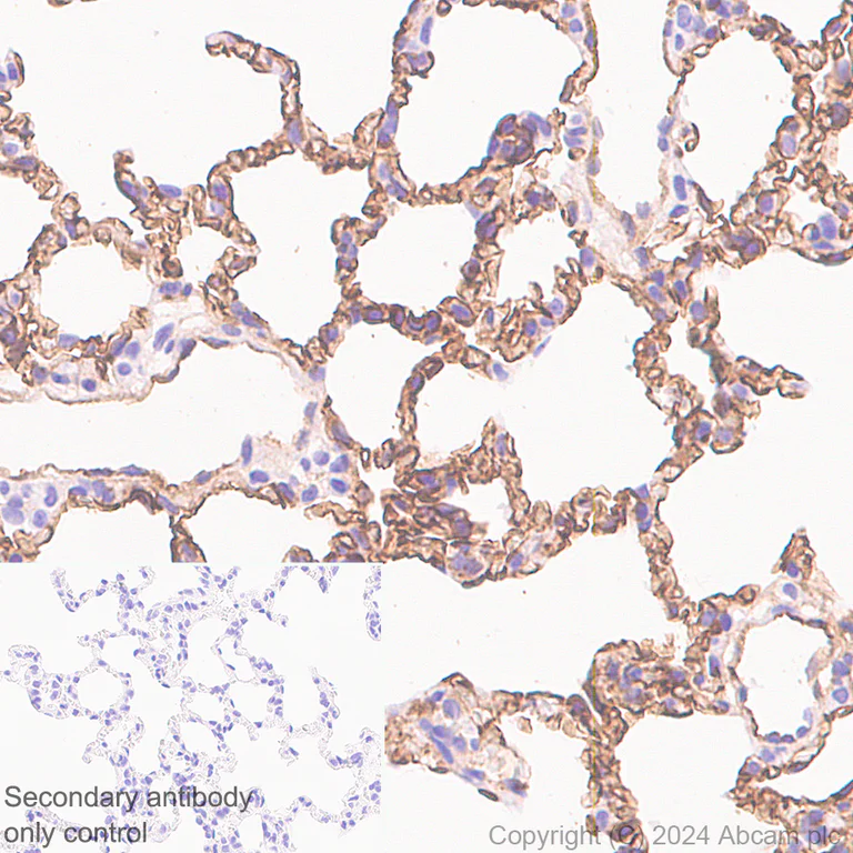 Immunohistochemistry (Formalin/PFA-fixed paraffin-embedded sections) - Anti-CD34 antibody [RM2052] - BSA and Azide free (AB317589)