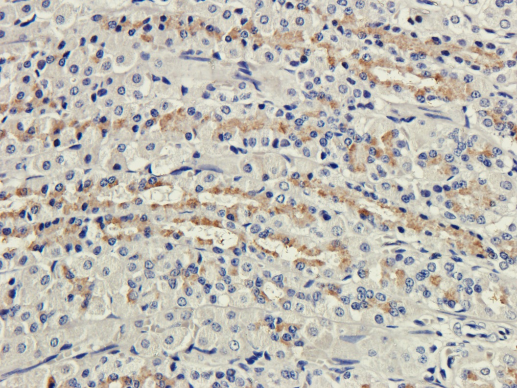 Immunohistochemistry (Formalin/PFA-fixed paraffin-embedded sections) - Anti-CD35 antibody [8C12] (AB245683), expandable thumbnail
