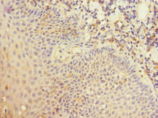 Immunohistochemistry (Formalin/PFA-fixed paraffin-embedded sections) - Anti-CD35 antibody (AB229875)