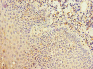 Immunohistochemistry (Formalin/PFA-fixed paraffin-embedded sections) - Anti-CD35 antibody (AB229875)