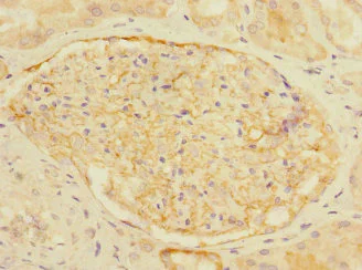 Immunohistochemistry (Formalin/PFA-fixed paraffin-embedded sections) - Anti-CD35 antibody (AB229875)