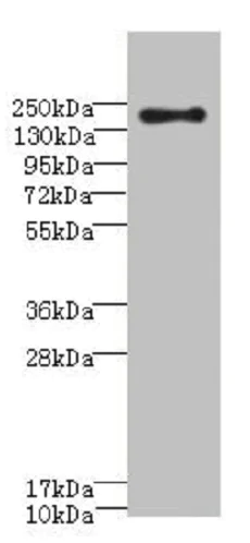 Western blot - Anti-CD35 antibody (AB229875)