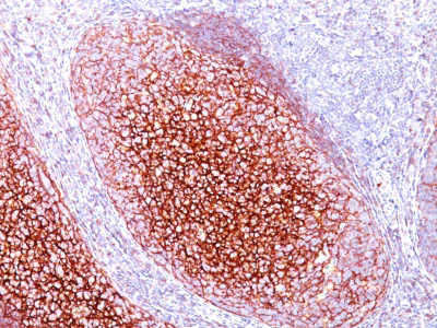 Immunohistochemistry (Formalin/PFA-fixed paraffin-embedded sections) - Anti-CD35 antibody [CR1/802] - BSA and Azide free (AB212311)