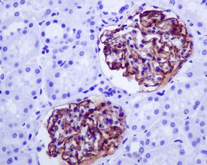 Immunohistochemistry (Formalin/PFA-fixed paraffin-embedded sections) - Anti-CD35 antibody [EPR6601] (AB133293)