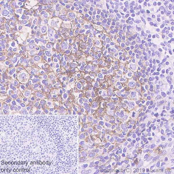 Immunohistochemistry (Formalin/PFA-fixed paraffin-embedded sections) - Anti-CD35 antibody [EPR6601] (AB133293)