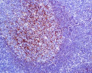 Immunohistochemistry (Formalin/PFA-fixed paraffin-embedded sections) - Anti-CD35 antibody [EPR6601] (AB133293)