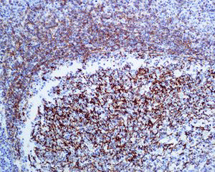 Immunohistochemistry (Formalin/PFA-fixed paraffin-embedded sections) - Anti-CD35 antibody [EPR6602] - BSA and Azide free (AB248156), expandable thumbnail