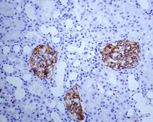 Immunohistochemistry (Formalin/PFA-fixed paraffin-embedded sections) - Anti-CD35 antibody [EPR6602] - BSA and Azide free (AB248156), expandable thumbnail