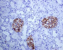 Immunohistochemistry (Formalin/PFA-fixed paraffin-embedded sections) - Anti-CD35 antibody [EPR6602] - BSA and Azide free (AB248156)