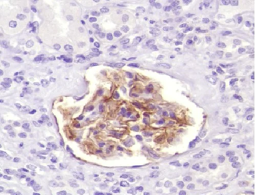 Immunohistochemistry (Formalin/PFA-fixed paraffin-embedded sections) - Anti-CD35 antibody [SP191] (AB227666)