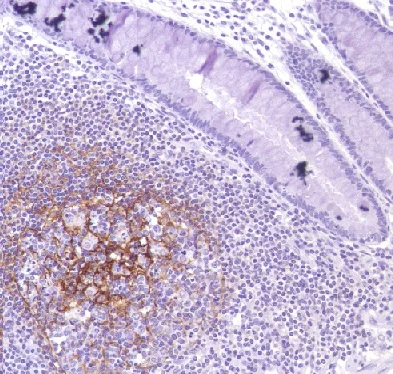 Immunohistochemistry (Formalin/PFA-fixed paraffin-embedded sections) - Anti-CD35 antibody [SP191] (AB227666)