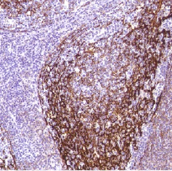 Immunohistochemistry (Formalin/PFA-fixed paraffin-embedded sections) - Anti-CD35 antibody [SP191] - BSA and Azide free (AB236236)