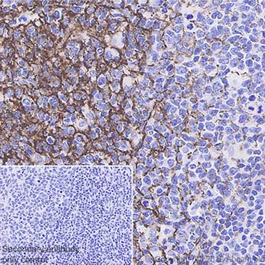 Immunohistochemistry (Formalin/PFA-fixed paraffin-embedded sections) - Anti-CD35 antibody [SP191] - BSA and Azide free (AB236236)