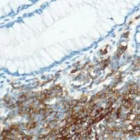 Immunohistochemistry (Formalin/PFA-fixed paraffin-embedded sections) - Anti-CD35 antibody [SP197] (AB183359)
