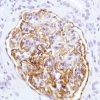 Immunohistochemistry (Formalin/PFA-fixed paraffin-embedded sections) - Anti-CD35 antibody [SP197] (AB183359)