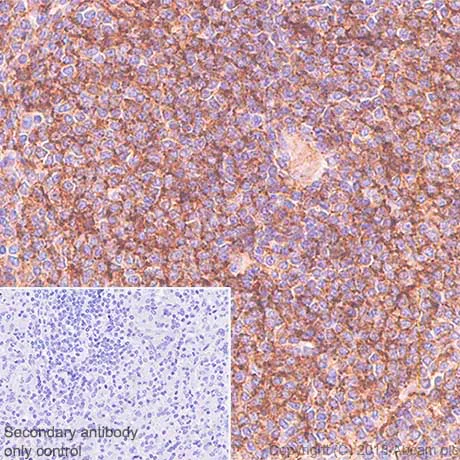 Immunohistochemistry (Formalin/PFA-fixed paraffin-embedded sections) - Anti-CD35 antibody [SP197] (AB183359)