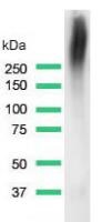 Western blot - Anti-CD35 antibody [SP197] (AB183359)