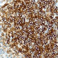 Immunohistochemistry (Formalin/PFA-fixed paraffin-embedded sections) - Anti-CD35 antibody [SP197] - BSA and Azide free (AB240961)