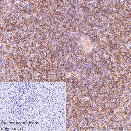 Immunohistochemistry (Formalin/PFA-fixed paraffin-embedded sections) - Anti-CD35 antibody [SP197] - BSA and Azide free (AB240961)