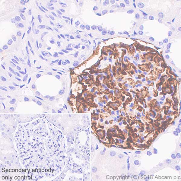 Immunohistochemistry (Formalin/PFA-fixed paraffin-embedded sections) - Anti-CD35 antibody [SP197] - BSA and Azide free (AB240961)