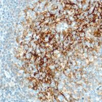 Immunohistochemistry (Formalin/PFA-fixed paraffin-embedded sections) - Anti-CD35 antibody [SP197] - BSA and Azide free (AB240961)