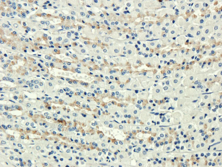Immunohistochemistry (Formalin/PFA-fixed paraffin-embedded sections) - Anti-CD35+CD21 antibody [7G6] (AB288422)