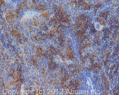 Immunohistochemistry (Formalin/PFA-fixed paraffin-embedded sections) - Anti-CD36 antibody (AB124515), expandable thumbnail
